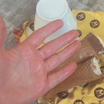 Yağ Sızdıran Magnum Dondurma Ve Kullanılamayan Telafi Çeki