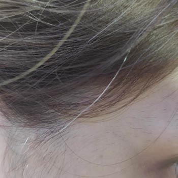 L'Oreal Saç Boyası Beyazları Kapatmadı, %100 Kapama Sözünü İhlal Etti