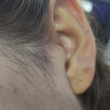 L'Oreal Saç Boyası Beyazları Kapatmadı, %100 Kapama Sözünü İhlal Etti