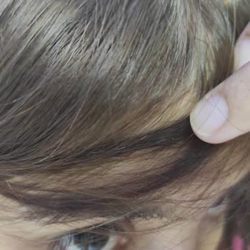 L'Oreal Saç Boyası Beyazları Kapatmadı, %100 Kapama Sözünü İhlal Etti