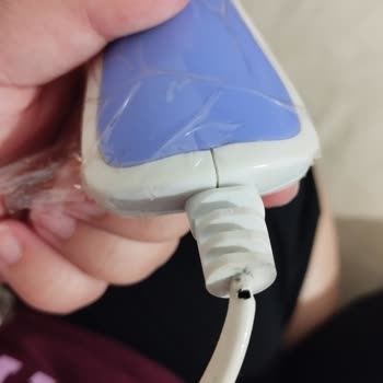 Kochler Kom-04 Selülit Masaj Aletinin Yangın Çıktığı Tehlikeli Olay