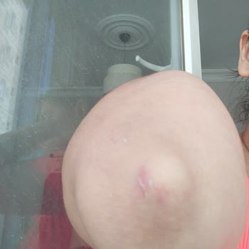 Armut Platformunda İş Kazası Sonrası Sorumluluk İhmalı