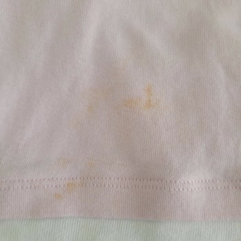 Ayıplı Profilo Çamaşır Makinesi Ve Haksız Servis Ücreti