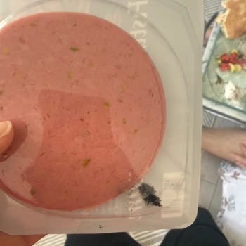 Namet Salamında Yabancı Cisim Tespiti Ve Gıda Güvenliği Endişesi