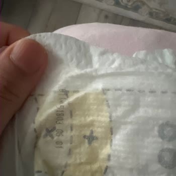 Prima Premium Care 2 Numaralı Bezlerde Sızıntı Sorunu Ve Kalite Kontrol Talebi