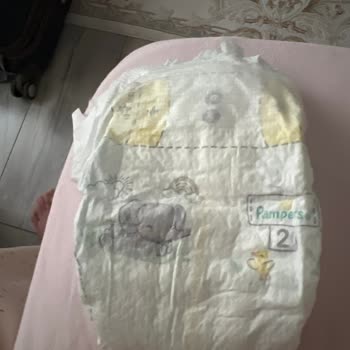 Prima Premium Care 2 Numaralı Bezlerde Sızıntı Sorunu Ve Kalite Kontrol Talebi