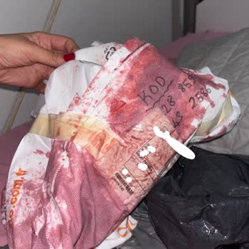 Trendyol Express'in Taşıma Hatası Ceketime Şekerli Madde Bulaştırdı