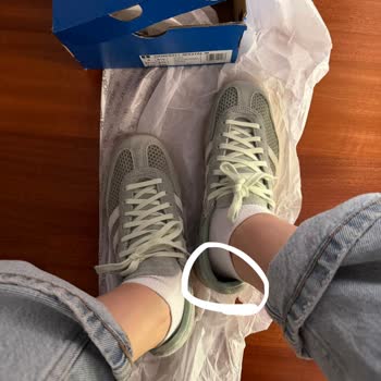 Adidas Üretim Hatası Sebebiyle Yanlış Boyutlu Ayakkabı Ve Reddedilen İade Talebi