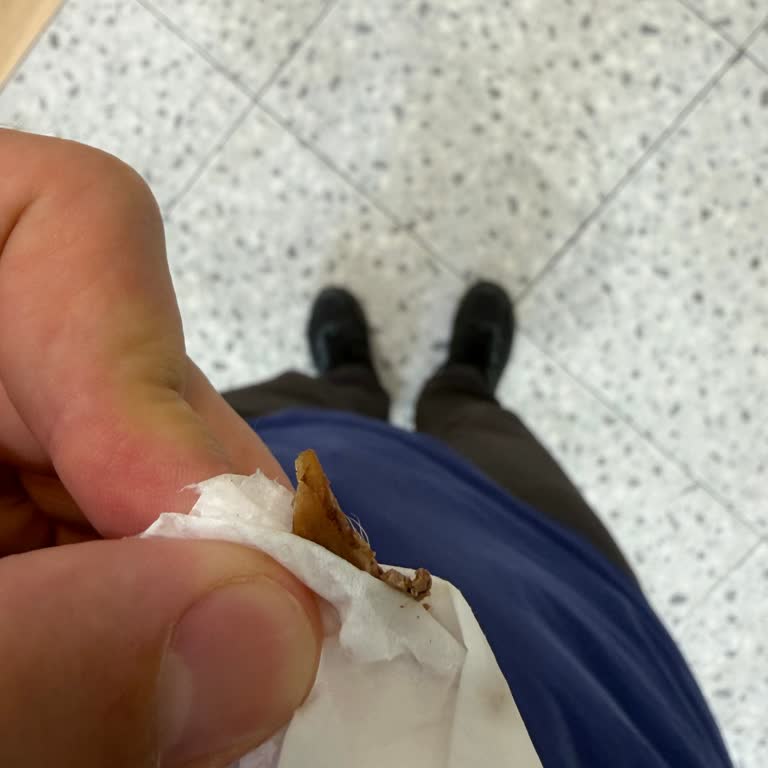 Hayvan Derisi İçeren Dönerde Hijyen İhlali Ve Aşsan Catering’in Soruşturulması Gerekiyor
