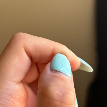 Azura Beauty & Aesthetics Yamuk Tırnak Ve Cevapsız Mesaj Mağduriyeti