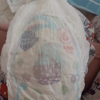 Molfix Bebek Bezi Üretim Hatası: Bantların Eksik Olması