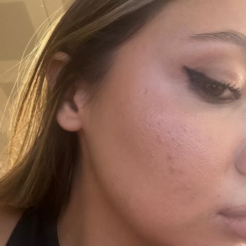 Hepsiburada'da Açık Paketli Sahte Kozmetik Ürünü Ve Sağlık Sorunu: Acil İade Talebi