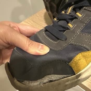 Skechers Çocuk Ayakkabısında Kısa Sürede Yırtılma Ve Kullanıcı Hatası İddiası
