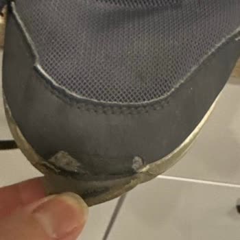Skechers Çocuk Ayakkabısında Kısa Sürede Yırtılma Ve Kullanıcı Hatası İddiası
