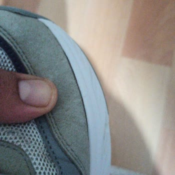Ayıplı Skechers Edgeride Model Ayakkabının İç Astarı Yırtıldı
