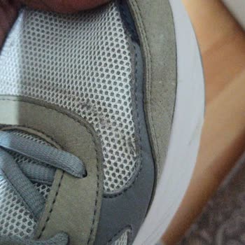 Ayıplı Skechers Edgeride Model Ayakkabının İç Astarı Yırtıldı