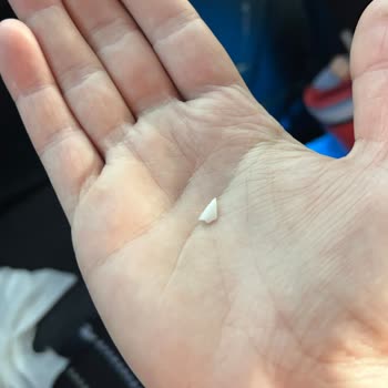 Burger King Nilüfer Şubesinde Dondurmasında Bulunan Plastik Parça: Hijyen Ve Güvenlik Sorunu