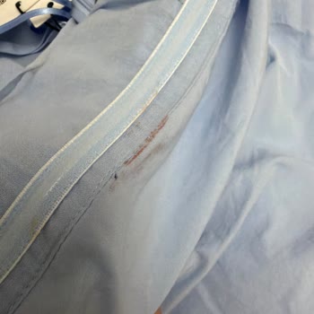 İpekyol'da Tekrarlanan Hasarlı Ürünler Güveni Zedeliyor