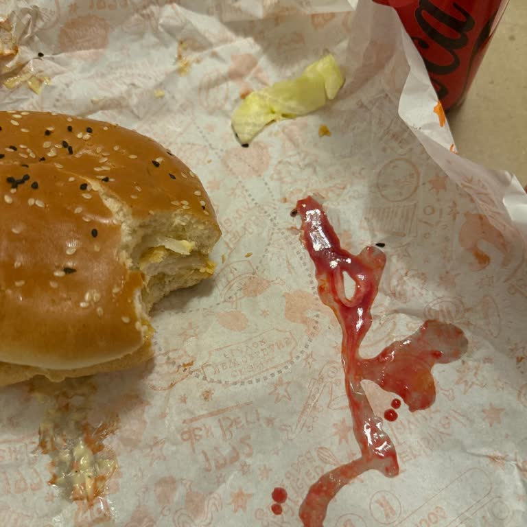 Hamburgerde Kemik Çıktı, Canlı Destek Yanıt Vermedi: İade Ve Sağlık Gideri Telafisi Talebi