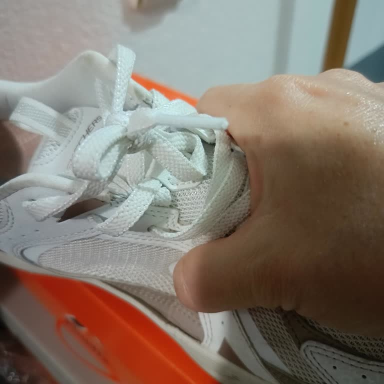 Kısa Sürede Yanlardan Açılan Skechers Ayakkabı İçin Üretim Hatası Ve İade Talebi