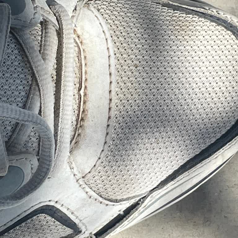 Skechers Shoe Stitching Come Out