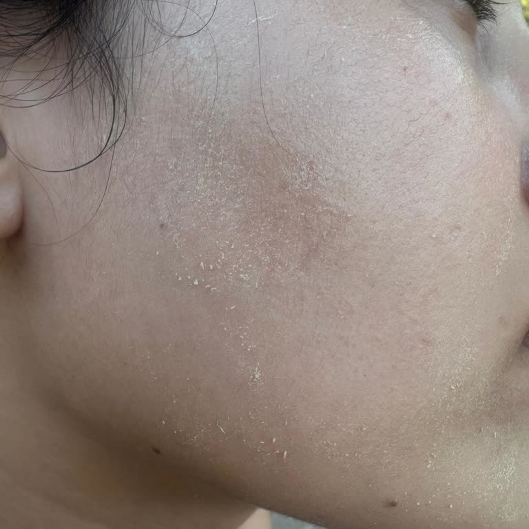 Avene Güneş Kreminde Cilt Sorunları Ve Trendyol’dan Cevapsız İade Talebi