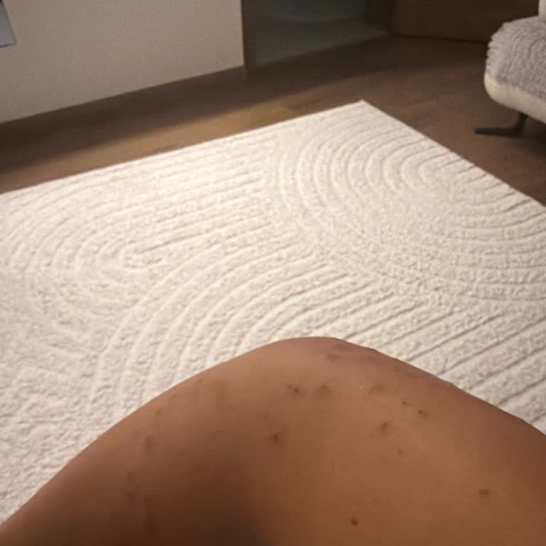 Kocaeli Şehir Hastanesi Çocuk Bölümünde Tahta Kuruşu Isırıkları Ve Hijyen İhmali