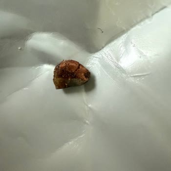Fellas Protein Bar’da Taş Benzeri Yabancı Cisim Ve Diş Ağrısı Şikayeti