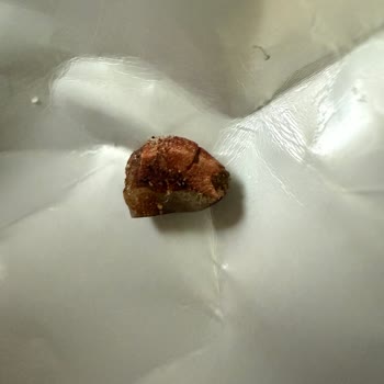 Fellas Protein Bar’da Taş Benzeri Yabancı Cisim Ve Diş Ağrısı Şikayeti