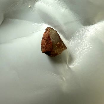 Fellas Protein Bar’da Taş Benzeri Yabancı Cisim Ve Diş Ağrısı Şikayeti