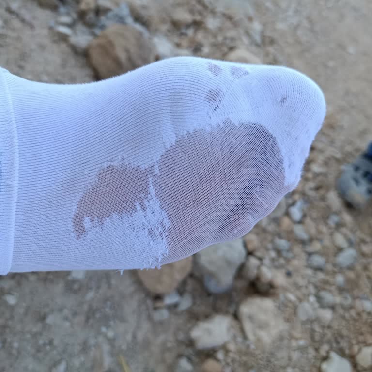 DeFacto Çoraplarında Hızlı Yıpranma Sorunu Güveni Sarsıyor
