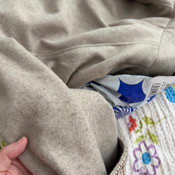 Defolu Mont Ve Şapka, Fiyat Farkı Ve Eksik Parça Şikayeti
