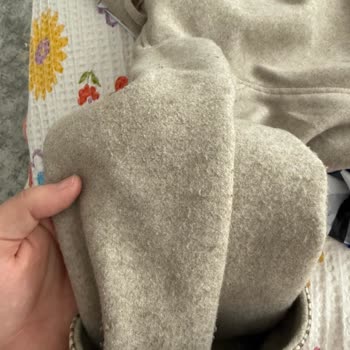 Defolu Mont Ve Şapka, Fiyat Farkı Ve Eksik Parça Şikayeti