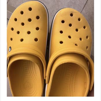 Sarı Crocs Terliği Hızla Çatladı Ve Müşteri Hizmetinden Cevap Gelmedi