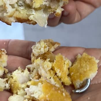 Burger King Hamburgerinde Metal Parça Bulunması Ve Diş Hasarı
