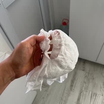 Altı Bez Aynı Yerden Yırtıldı Sleepy Bio Natural Air Bag Kalite Sorunu Ve İnceleme Talebi