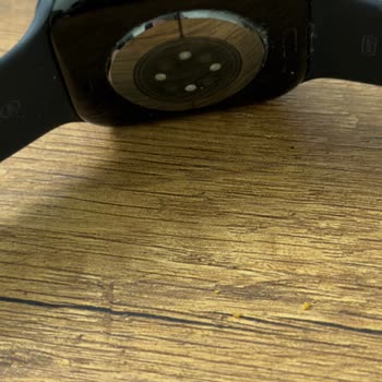 Apple Akıllı Saatin Kasa Boya Sorunu Ve Yan Düğüm Arızası İçin Ücretli Değişim Kabul Edilemez