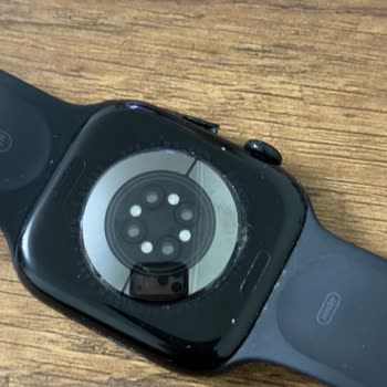 Apple Akıllı Saatin Kasa Boya Sorunu Ve Yan Düğüm Arızası İçin Ücretli Değişim Kabul Edilemez