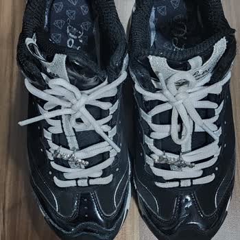 Sadece 7 Ayda Yırtılan Skechers D'Lites Ayakkabıda Üretim Kusuru Ve Müşteri Hizmetleri İhmali