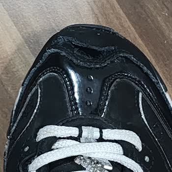 Sadece 7 Ayda Yırtılan Skechers D'Lites Ayakkabıda Üretim Kusuru Ve Müşteri Hizmetleri İhmali