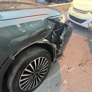 Ağır Kazada Airbag Açılmadı, Kasko Süreci Haksız Ücretlerle Uzadı