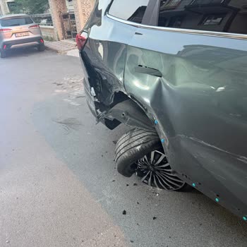 Ağır Kazada Airbag Açılmadı, Kasko Süreci Haksız Ücretlerle Uzadı