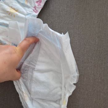 Molfix Bebek Bezi Üretim Hatası Ve Emici Kısmın Yanlış Konumlanması