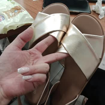 Deichmann Sandaletimde Ayağım Yaralandı, Hızlı Deformasyon Ve Numara Değişimi Reddedildi