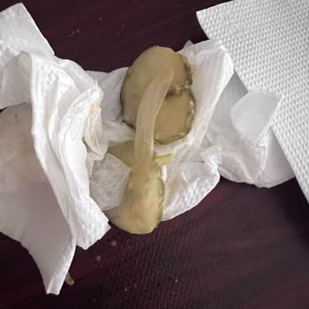 Turşu Alerjisine Rağmen Siparişte Yanlışlık Ve Yetersiz Telafi