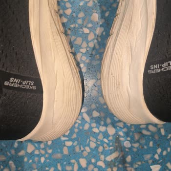 İç Topuk Basma Problemi Nedeniyle Skechers Ayakkabının Değişim Ve İadesi Talep Ediliyor