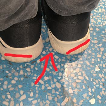 İç Topuk Basma Problemi Nedeniyle Skechers Ayakkabının Değişim Ve İadesi Talep Ediliyor