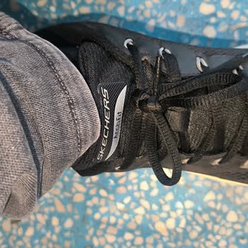 İç Topuk Basma Problemi Nedeniyle Skechers Ayakkabının Değişim Ve İadesi Talep Ediliyor