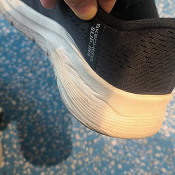 İç Topuk Basma Problemi Nedeniyle Skechers Ayakkabının Değişim Ve İadesi Talep Ediliyor