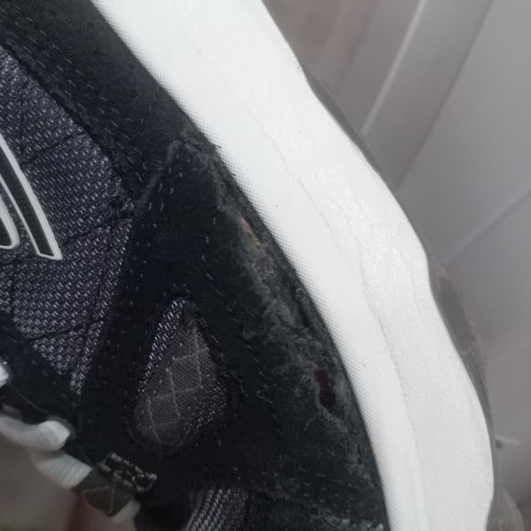 Skechers Ayakkabısında Garantili Açılma Sorunu Ve Müşteri Memnuniyetsizliği